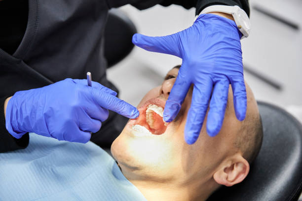 Best Broken or Chipped Tooth Repair in Lake Royale, NC